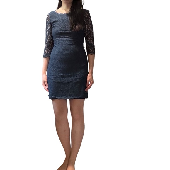 Aritzia babaton Rafael lace dress - Picture 1 of 2